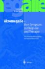 Image for Akromegalie - Vom Symptom zu Diagnose und Therapie : Eine klinische Monographie mit Patientenberichten