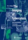 Image for The Imaging of Tuberculosis : With Epidemiological, Pathological and Clinical Correlation
