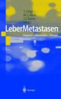 Image for Lebermetastasen
