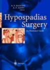 Image for Hypospadias surgery  : art and science
