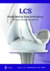 Image for Lcs Mobile Bearing Knee Arthroplasty