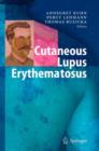 Image for Cutaneous Lupus Erythematosus