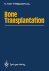 Image for Bone Transplantation