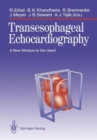 Image for Transesophageal Echocardiography
