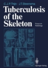 Image for Tuberculosis of the Skeleton