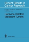 Image for Hormone-Related Malignant Tumors