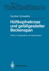 Image for Huftkopfnekrose und gefaßgestielter Beckenspan : Studie zu Angiographie und Vaskularisation