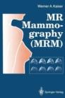 Image for MR Mammography (MRM)