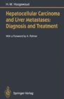 Image for Hepatocellular Carcinoma and Liver Metastases : Diagnosis and Treatment