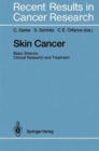 Image for Skin Cancer : Basic Science, Clinical Research and Treatment