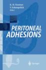 Image for Peritoneal Adhesions