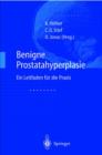 Image for Benigne Prostatahyperplasie