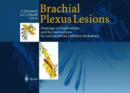 Image for Brachial Plexus Lesions