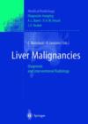 Image for Liver Malignancies