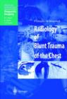 Image for Radiology of Blunt Trauma of the Chest