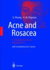 Image for Acne and Rosacea