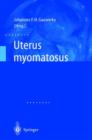 Image for Uterus Myomatosus