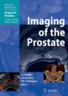 Image for Imaging of the Prostate
