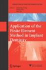 Image for Application of the finite element method in implant dentistry