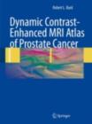 Image for Dynamic contrast-enhanced MRI atlas of prostate cancer