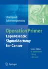 Image for Laparoscopic Sigmoidectomy for Cancer