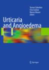 Image for Urticaria and angioedema