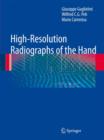 Image for High-Resolution Radiographs of the Hand