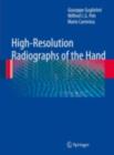 Image for High-resolution radiographs of the hand