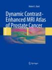 Image for Dynamic Contrast-Enhanced MRI Atlas of Prostate Cancer