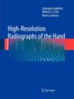 Image for High-Resolution Radiographs of the Hand