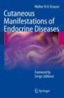Image for Cutaneous manifestations of endocrine diseases