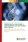 Image for Radioinjuria associada a polimorfismo em pacientes com cancer