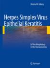 Image for Herpes Simplex Virus Epithelial Keratitis