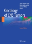 Image for Oncology of CNS tumors