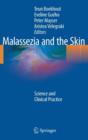 Image for Malassezia and the Skin