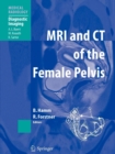 Image for MRI and CT of the Female Pelvis