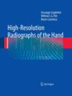 Image for High-Resolution Radiographs of the Hand