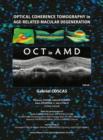 Image for Optical Coherence Tomography in Age-Related Macular Degeneration