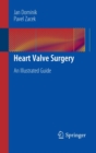 Image for Heart valve surgery: an illustrated guide