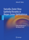 Image for Varicella-Zoster Virus Epithelial Keratitis in Herpes Zoster Ophthalmicus: In Vivo Morphology in the Human Cornea