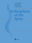 Image for Arthroplasty of the Spine