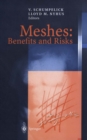 Image for Meshes: Benefits and Risks