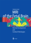 Image for MRI of the Fetal Brain: Normal Development and Cerebral Pathologies