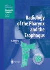 Image for Radiology of the Pharynx and the Esophagus