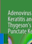 Image for Adenovirus epithelial keratitis and Thygeson&#39;s superficial punctate keratitis: in vivo morphology in the human cornea