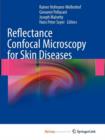 Image for Reflectance Confocal Microscopy for Skin Diseases