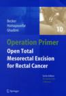 Image for Open total mesorectal (TME) for cancer