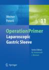 Image for Laparoscopic Gastric Sleeve
