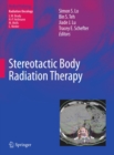 Image for Stereotactic body radiation therapy
