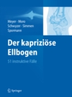 Image for Der kapriziose Ellbogen: 51 instruktive Falle